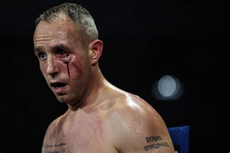 bare knuckle fighting results